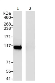 Immunoprecipitation - Anti-SFPQ antibody (AB264196)