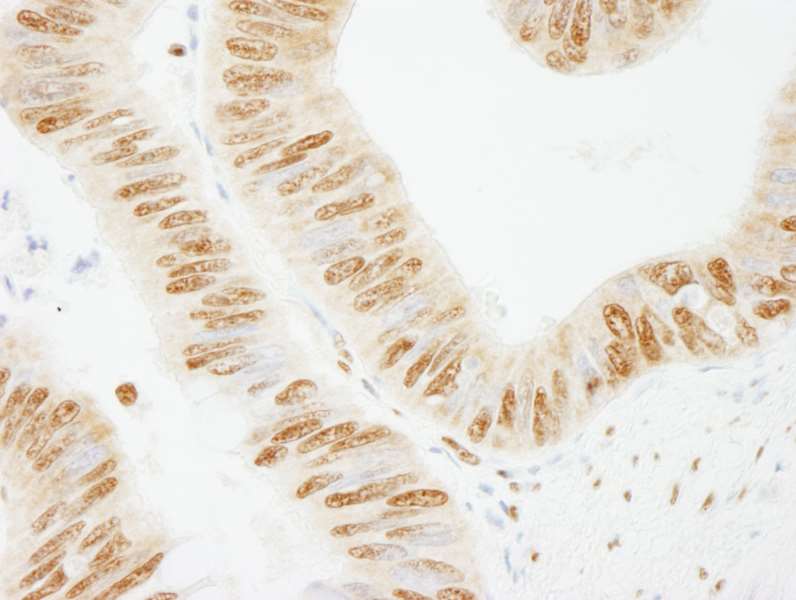 Immunohistochemistry (Formalin/PFA-fixed paraffin-embedded sections) - Anti-SFPQ antibody (AB264197), expandable thumbnail