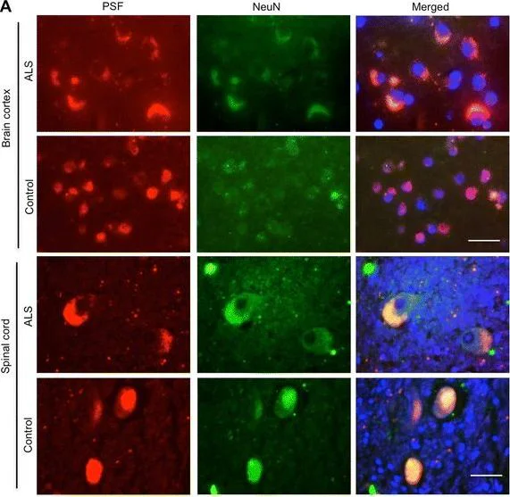Immunocytochemistry/ Immunofluorescence - Anti-SFPQ antibody (AB38148)
