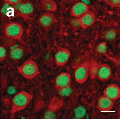 Immunocytochemistry/ Immunofluorescence - Anti-SFPQ antibody (AB38148)