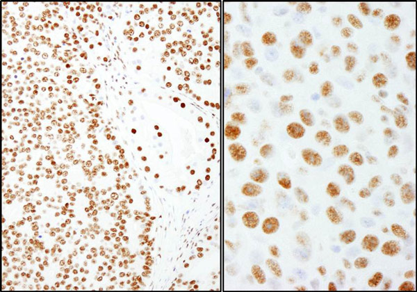Immunohistochemistry (Formalin/PFA-fixed paraffin-embedded sections) - Anti-SFPQ antibody (AB99357), expandable thumbnail