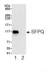 Immunoprecipitation - Anti-SFPQ antibody (AB99357), expandable thumbnail