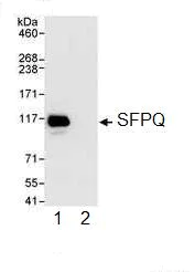 Immunoprecipitation - Anti-SFPQ antibody (AB99357)
