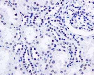 Immunohistochemistry (Formalin/PFA-fixed paraffin-embedded sections) - Anti-SFPQ antibody [EPR11846] (AB177936)