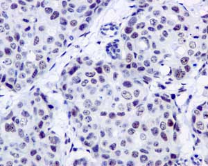 Immunohistochemistry (Formalin/PFA-fixed paraffin-embedded sections) - Anti-SFPQ antibody [EPR11846] - BSA and Azide free (AB250011)