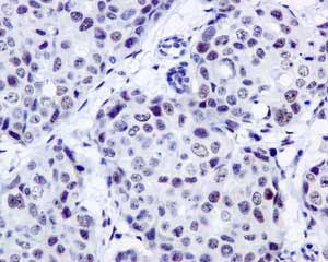 Immunohistochemistry (Formalin/PFA-fixed paraffin-embedded sections) - Anti-SFPQ antibody [EPR11846] - BSA and Azide free (AB250011)