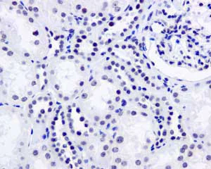 Immunohistochemistry (Formalin/PFA-fixed paraffin-embedded sections) - Anti-SFPQ antibody [EPR11846] - BSA and Azide free (AB250011)
