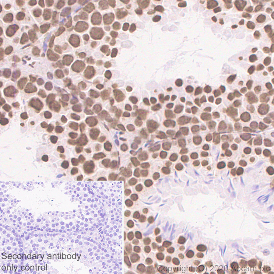 Immunohistochemistry (Formalin/PFA-fixed paraffin-embedded sections) - Anti-SFPQ antibody [EPR11847] (AB177149), expandable thumbnail