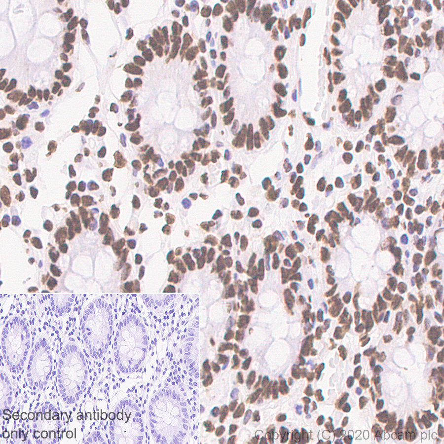 Immunohistochemistry (Formalin/PFA-fixed paraffin-embedded sections) - Anti-SFPQ antibody [EPR11847] (AB177149), expandable thumbnail