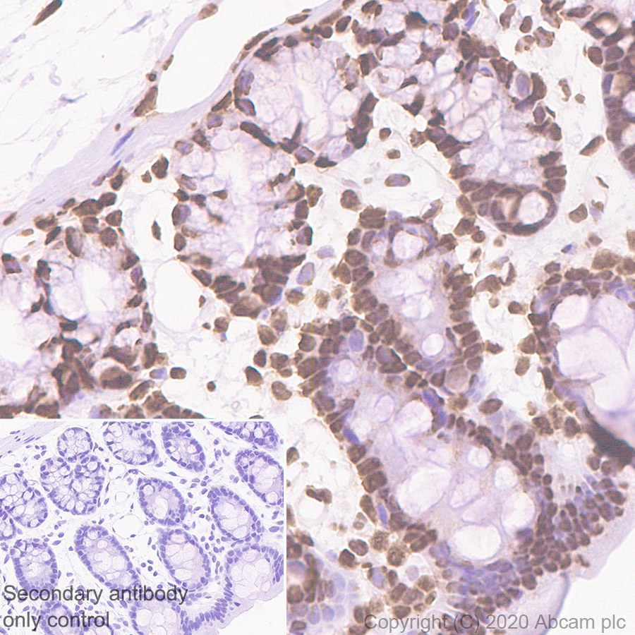 Immunohistochemistry (Formalin/PFA-fixed paraffin-embedded sections) - Anti-SFPQ antibody [EPR11847] (ab177149), expandable thumbnail