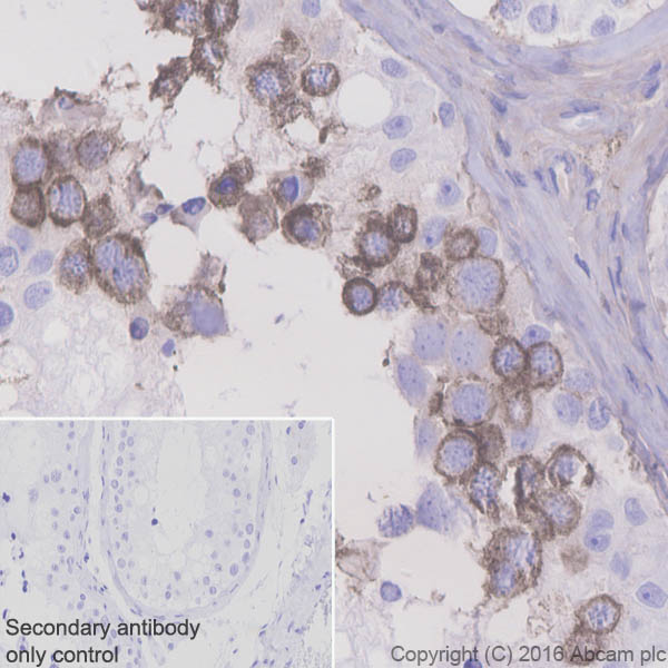 Immunohistochemistry (Formalin/PFA-fixed paraffin-embedded sections) - Anti-SFRP1 antibody [EPR7003] (AB126613), expandable thumbnail