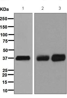 Western blot - Anti-SFRP1 antibody [EPR7003] (AB126613), expandable thumbnail