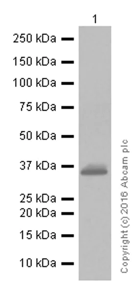 Western blot - Anti-SFRP1 antibody [EPR7003] (AB126613)