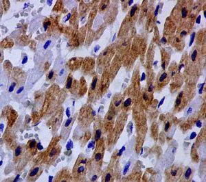 Immunohistochemistry (Formalin/PFA-fixed paraffin-embedded sections) - Anti-SFRP1 antibody [EPR7003] - BSA and Azide free (AB240023)