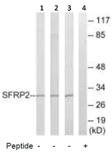 Western blot - Anti-SFRP2 antibody (AB92667)