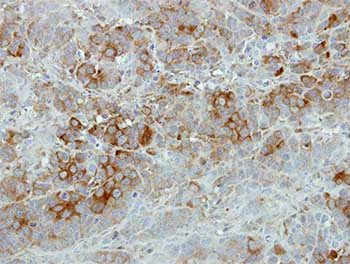 Immunohistochemistry (Formalin/PFA-fixed paraffin-embedded sections) - Anti-SFRP2 antibody - C-terminal (AB137560)