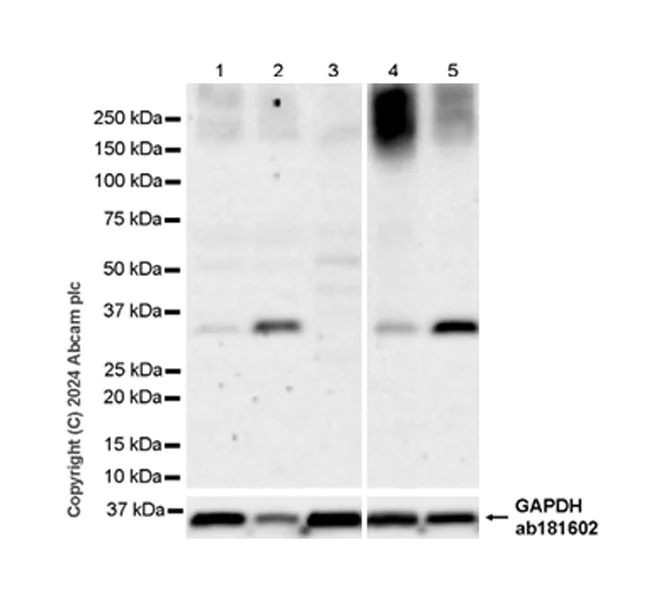 Western blot - Anti-SFRP2 antibody [EPR26088-157] - BSA and Azide free (AB318186)