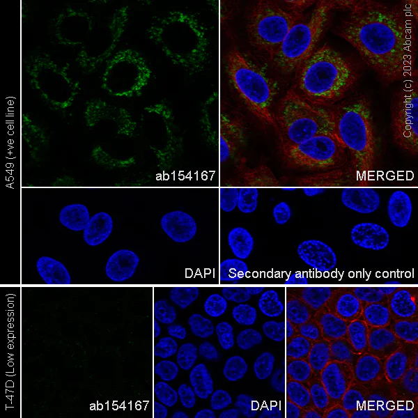 Immunocytochemistry/ Immunofluorescence - Anti-SFRP4 antibody [EPR9389] (AB154167)