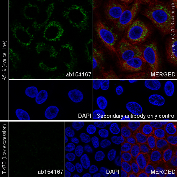 Immunocytochemistry/ Immunofluorescence - Anti-SFRP4 antibody [EPR9389] - BSA and Azide free (AB240126), expandable thumbnail