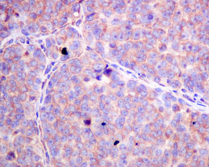 Immunohistochemistry (Formalin/PFA-fixed paraffin-embedded sections) - Anti-SFRP4 antibody [EPR9389] - BSA and Azide free (AB240126), expandable thumbnail