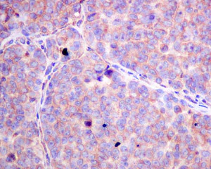 Immunohistochemistry (Formalin/PFA-fixed paraffin-embedded sections) - Anti-SFRP4 antibody [EPR9389] - BSA and Azide free (AB240126)