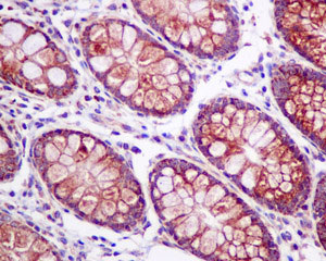 Immunohistochemistry (Formalin/PFA-fixed paraffin-embedded sections) - Anti-SFRP4 antibody [EPR9389] - BSA and Azide free (AB240126), expandable thumbnail