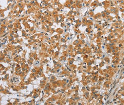 Immunohistochemistry (Formalin/PFA-fixed paraffin-embedded sections) - Anti-SFRP5 antibody (AB198206), expandable thumbnail