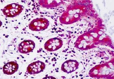 Immunohistochemistry (Formalin/PFA-fixed paraffin-embedded sections) - Anti-SFRP5 antibody (AB230425)