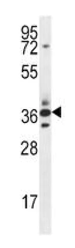 Western blot - Anti-SFRP5 antibody (AB230425)