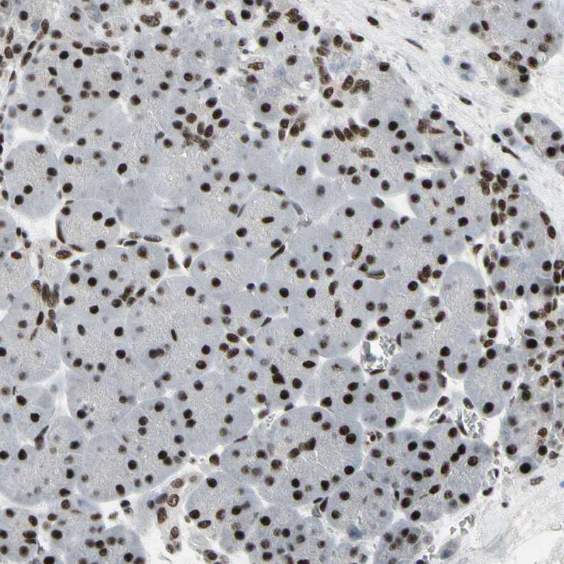 Immunohistochemistry (Formalin/PFA-fixed paraffin-embedded sections) - Anti-SFRS11 antibody (AB254733)