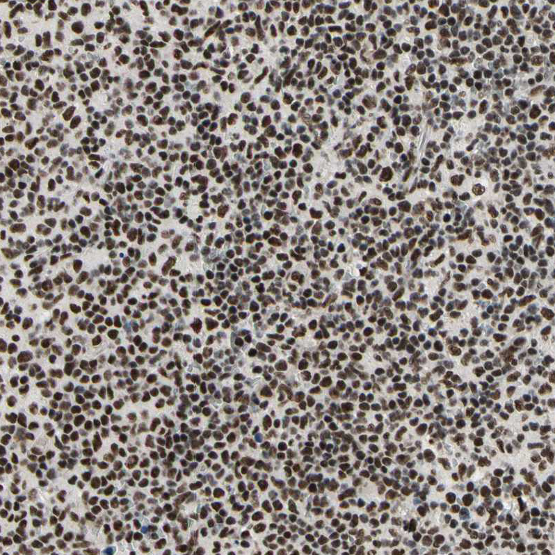 Immunohistochemistry (Formalin/PFA-fixed paraffin-embedded sections) - Anti-SFRS11 antibody (AB254733)