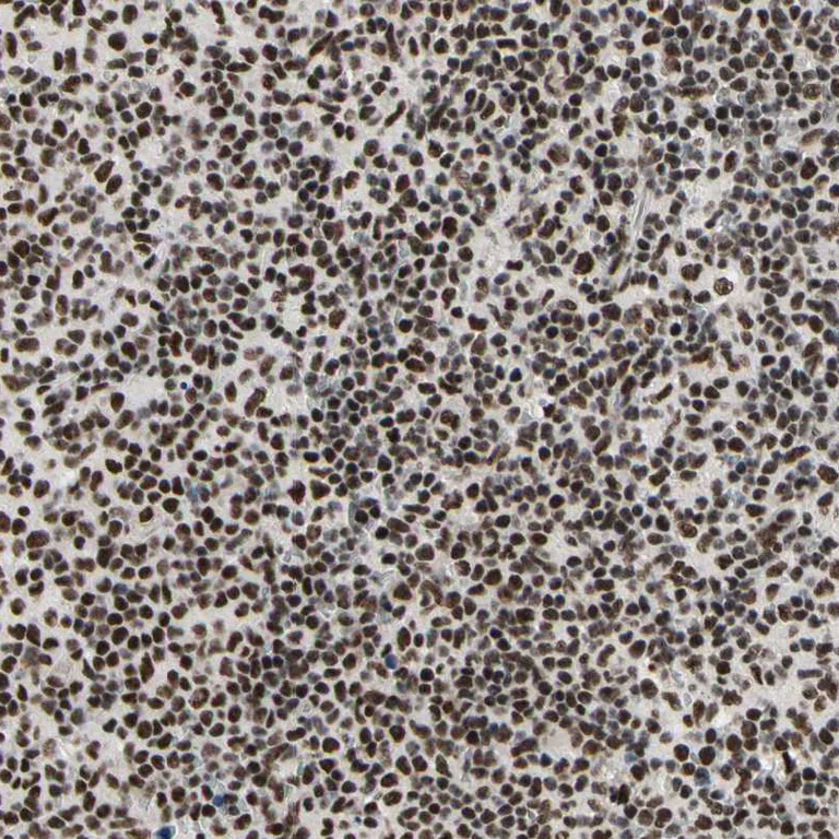 Immunohistochemistry (Formalin/PFA-fixed paraffin-embedded sections) - Anti-SFRS11 antibody (AB254733)