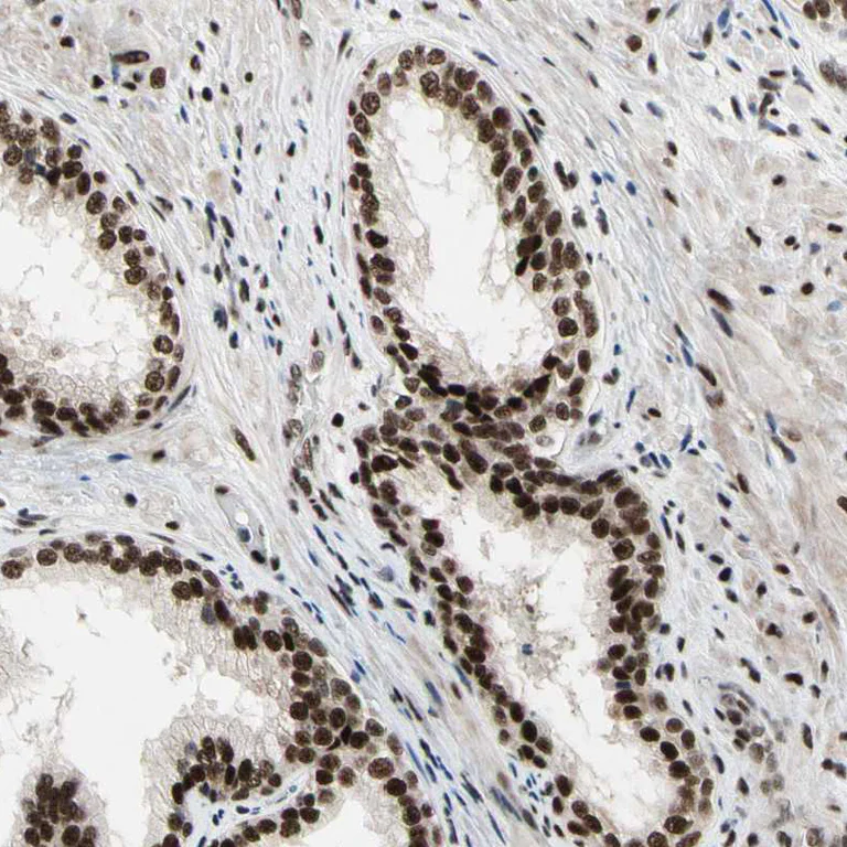 Immunohistochemistry (Formalin/PFA-fixed paraffin-embedded sections) - Anti-SFRS11 antibody (AB254733)