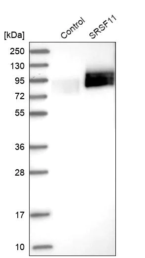 Western blot - Anti-SFRS11 antibody (AB254733)