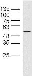 Western blot - Anti-SFRS4/SRSF4 antibody (AB217285), expandable thumbnail