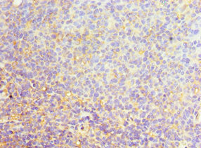 Immunohistochemistry (Formalin/PFA-fixed paraffin-embedded sections) - Anti-SFRS4/SRSF4 antibody (AB235606)