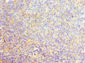 Immunohistochemistry (Formalin/PFA-fixed paraffin-embedded sections) - Anti-SFRS4/SRSF4 antibody (AB235606)