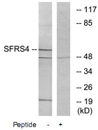 Western blot - Anti-SFRS4/SRSF4 antibody (AB73893)