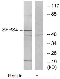 Western blot - Anti-SFRS4/SRSF4 antibody (AB73893)