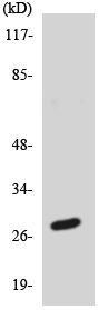 Western blot - Anti-SFRS7/SRSF7 antibody (AB138022), expandable thumbnail