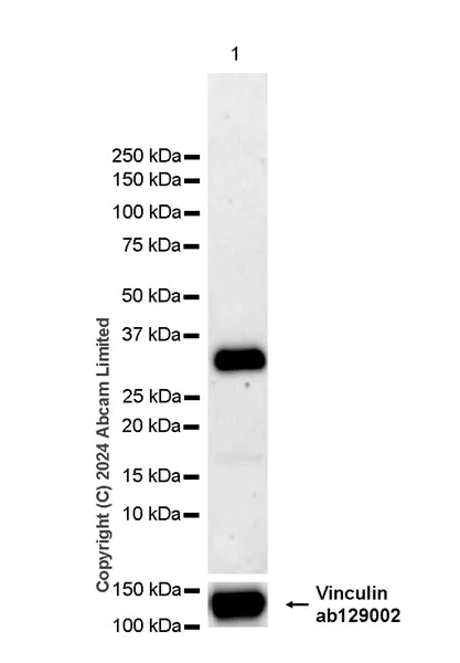 Western blot - Anti-SFRS7/SRSF7 antibody [EPR28621-501] (AB322406)