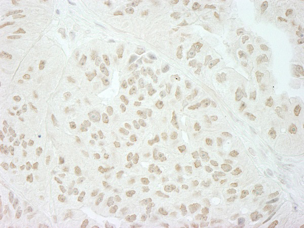 Immunohistochemistry (Formalin/PFA-fixed paraffin-embedded sections) - Anti-SFRS8 antibody (AB72044), expandable thumbnail