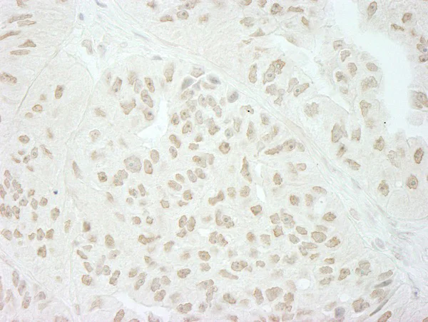 Immunohistochemistry (Formalin/PFA-fixed paraffin-embedded sections) - Anti-SFRS8 antibody (AB72044)