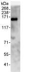 Immunoprecipitation - Anti-SFRS8 antibody (AB72044), expandable thumbnail