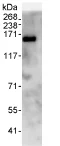 Immunoprecipitation - Anti-SFRS8 antibody (AB72044)