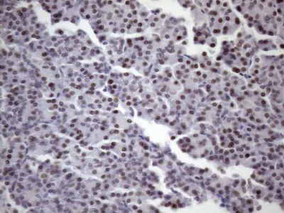 Immunohistochemistry (Formalin/PFA-fixed paraffin-embedded sections) - Anti-SFRS9/SRSF9 antibody [OTI5G7] (AB236414)