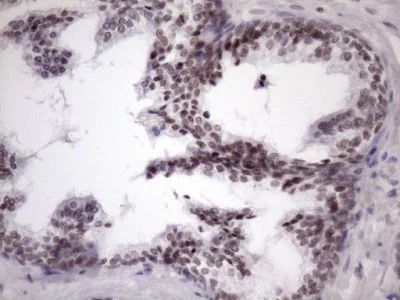 Immunohistochemistry (Formalin/PFA-fixed paraffin-embedded sections) - Anti-SFRS9/SRSF9 antibody [OTI5G7] (AB236414)