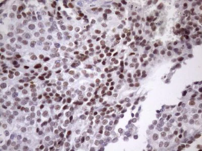 Immunohistochemistry (Formalin/PFA-fixed paraffin-embedded sections) - Anti-SFRS9/SRSF9 antibody [OTI5G7] (AB236414)