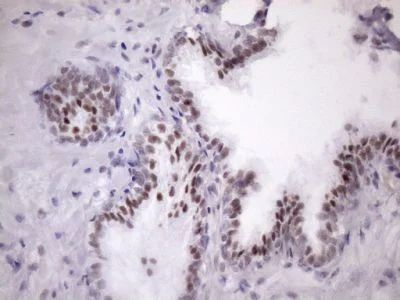 Immunohistochemistry (Formalin/PFA-fixed paraffin-embedded sections) - Anti-SFRS9/SRSF9 antibody [OTI5G7] (AB236414)
