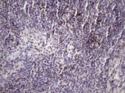 Immunohistochemistry (Formalin/PFA-fixed paraffin-embedded sections) - Anti-SFRS9/SRSF9 antibody [OTI5G7] (AB236414)